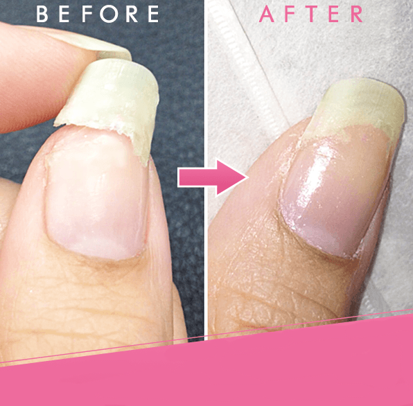 Belleza's Nail Gel